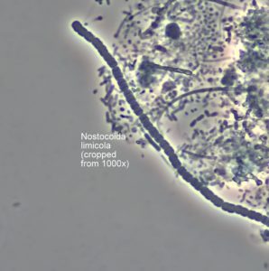 Nostocoida Limicola Microbe
