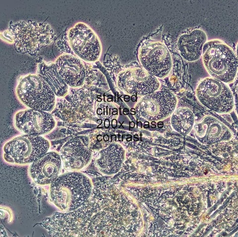 Stalked Ciliates 200 times with Phase Contrast