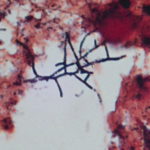 Actinomycetes-Mycolata Gram positive cropped from 1000x (1)