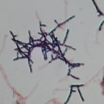 Actinomycetes-Mycolata cropped from 1000x Gram stain. (1)