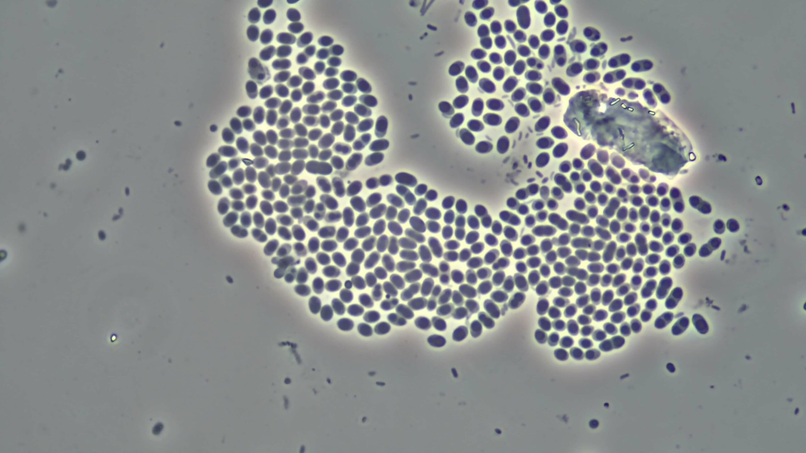 Globular Zoogloea cropped from 1000x DIC scaled